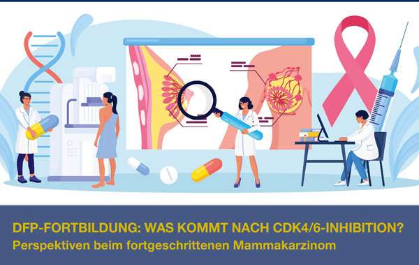 Was kommt nach CDK4/6-Inhibition? Perspektiven beim fortgeschrittenen Mammakarzinom