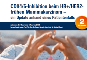 CDK4/6‑Inhibition beim HR+/HER2- frühen Mammakarzinom – ein Update anhand eines Patientenfalls